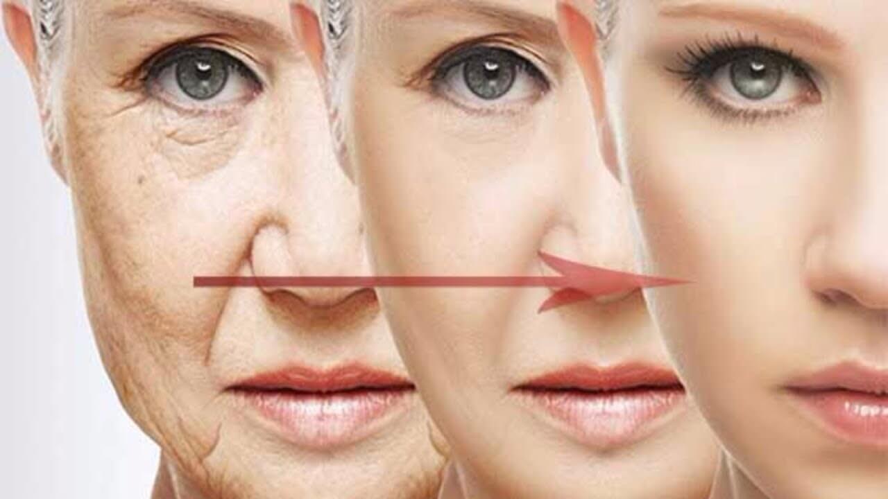 Fine lines and wrinkles - Early Signs of Aging