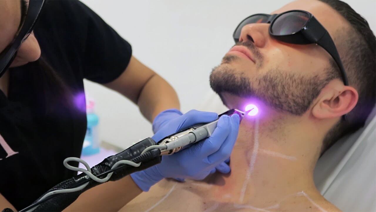 Smooth Skin with Laser Treatment
