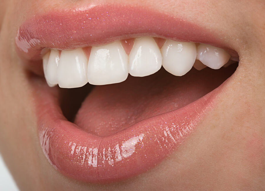 Home Remedies for Instant Teeth Whitening