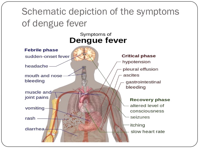 dengue-fever-symptoms