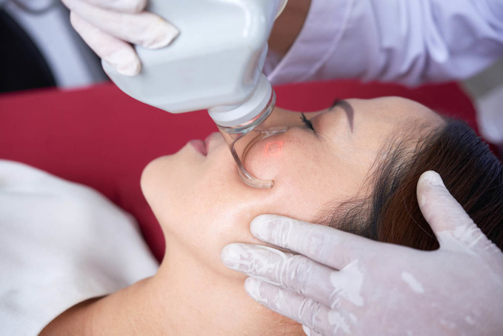 Effective Treatment Options for Laser Pigmentation Removal in Singapore