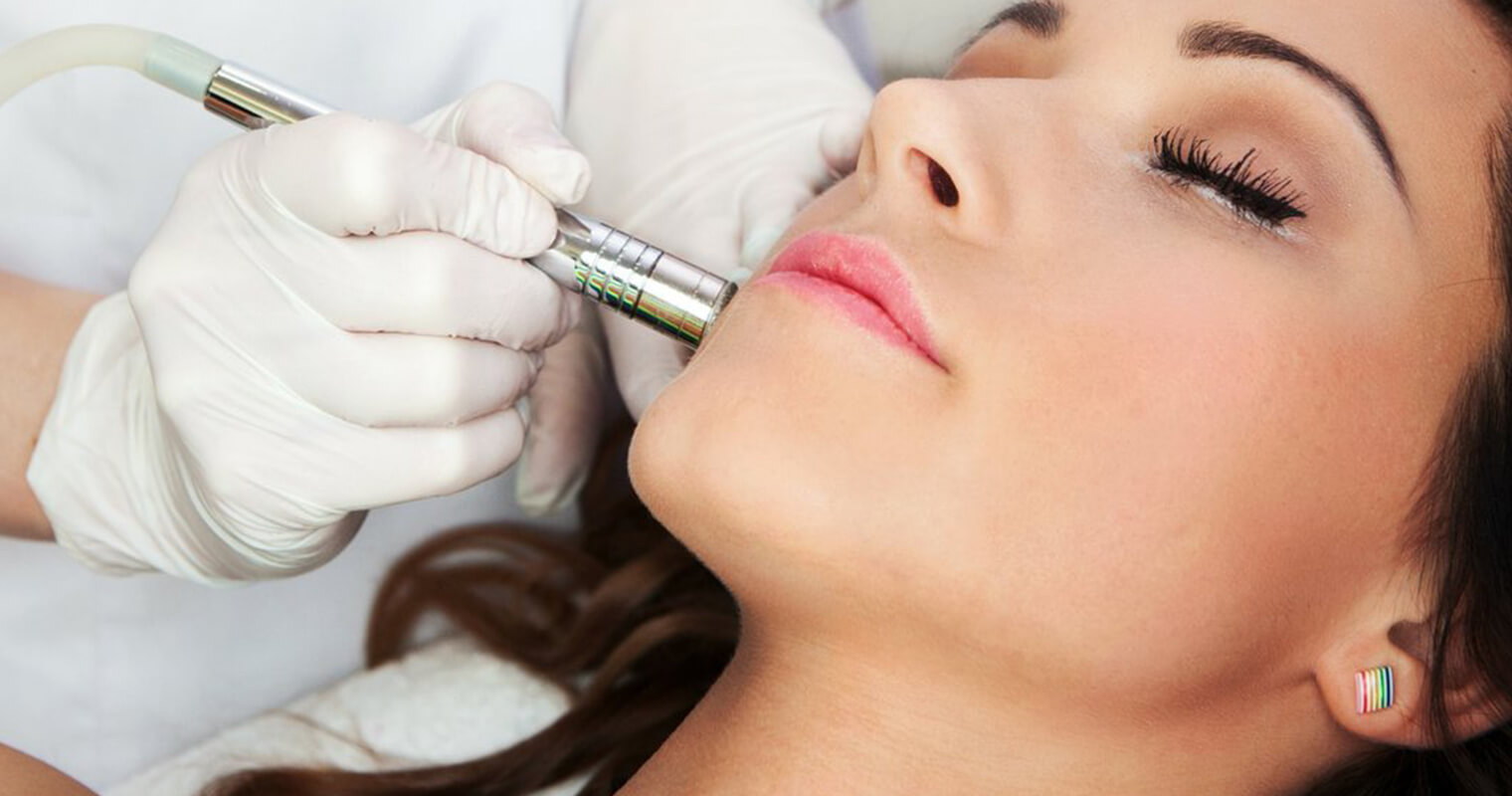 Microdermabrasion