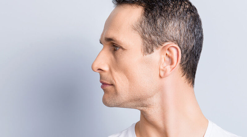 Challenges Involved with Reconstructive Rhinoplasty