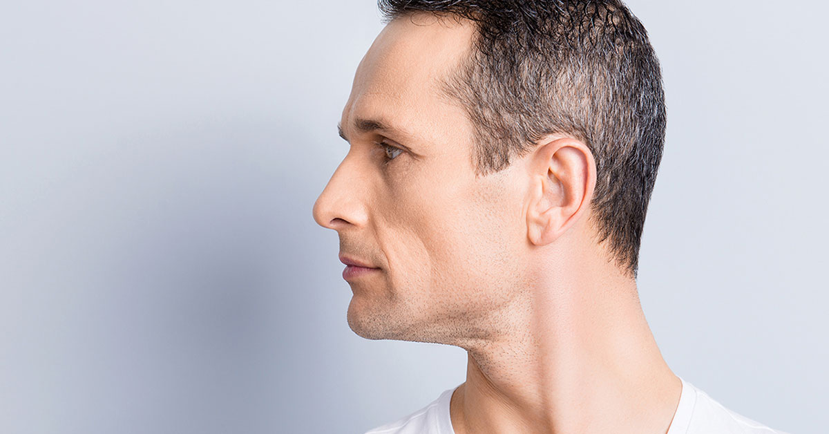Challenges Involved with Reconstructive Rhinoplasty 