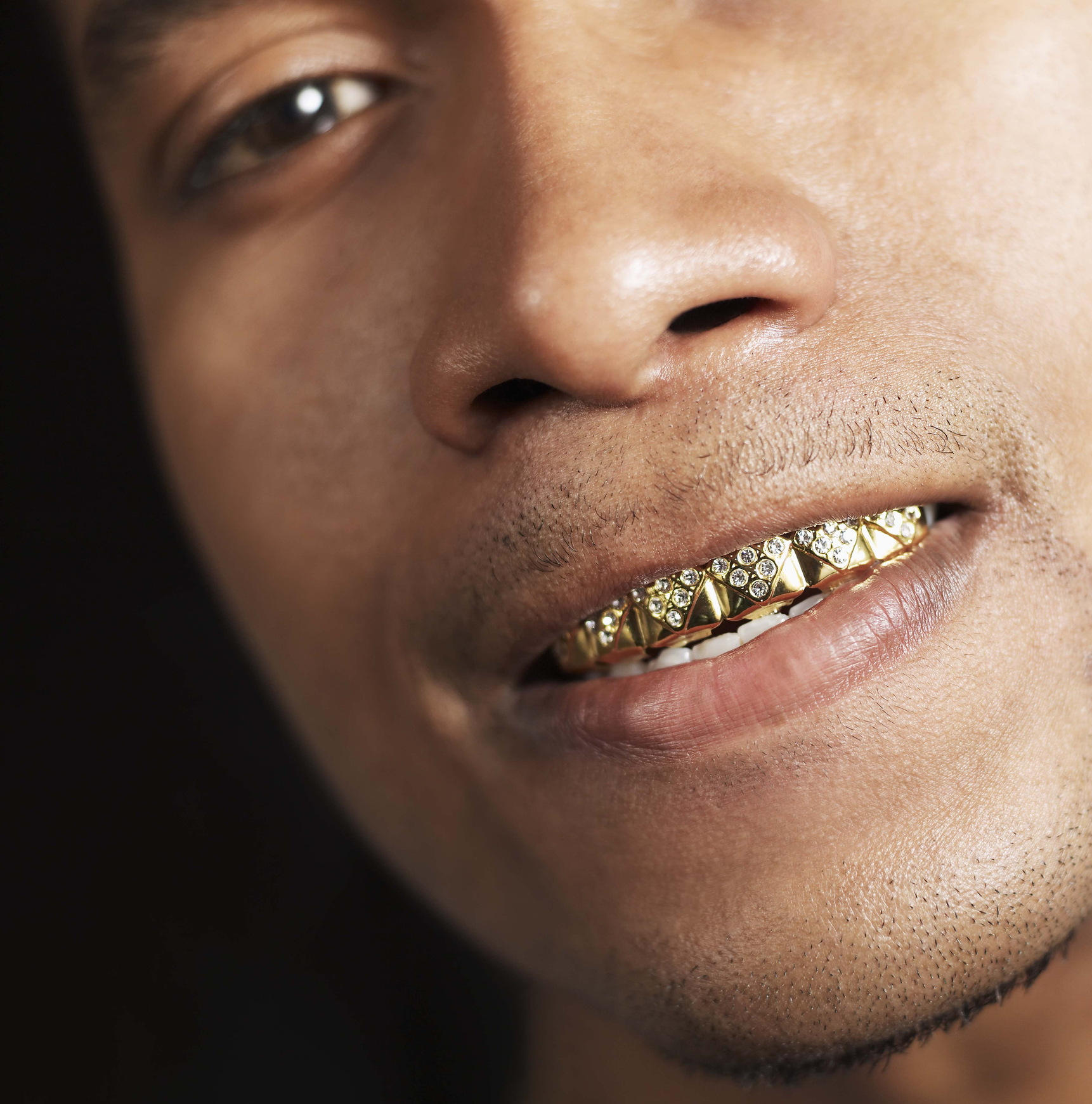 Gold tooth vs Grills 