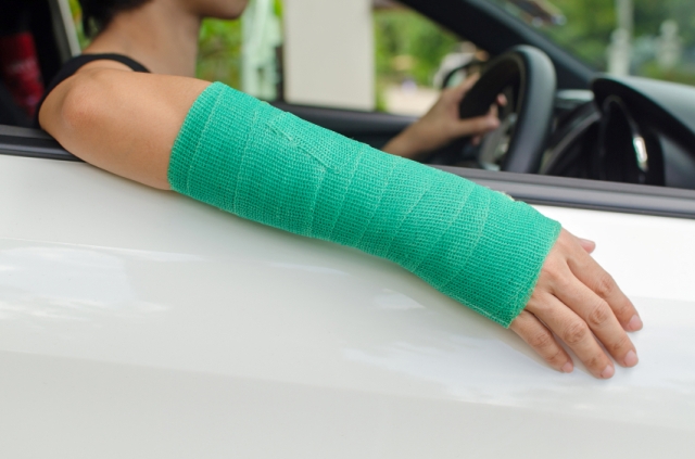 Broken Bone Injury Claim 