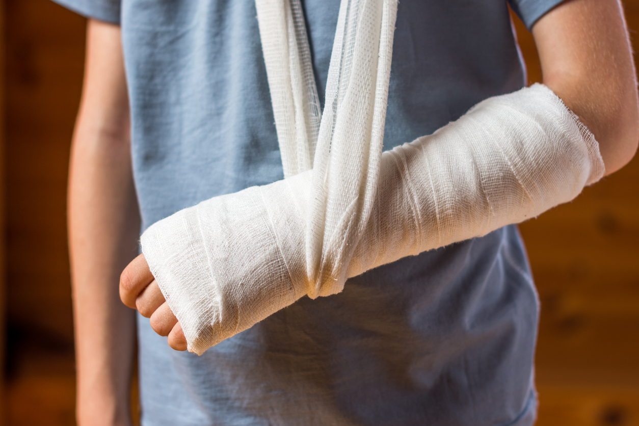 Broken Bone Injury Claim 