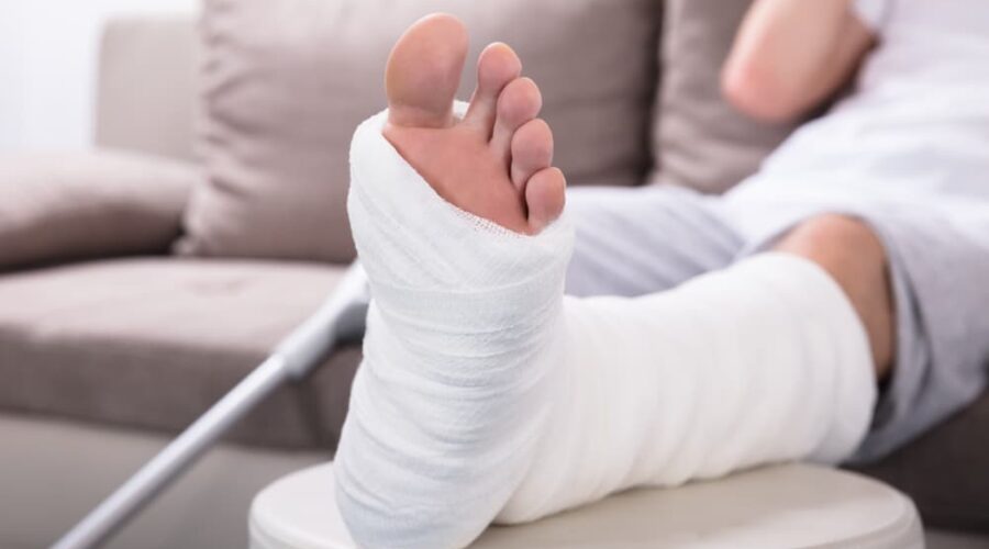 Broken Bone Injury Claim