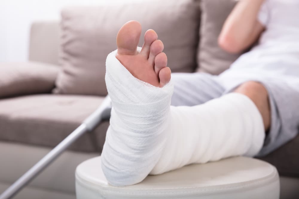 Broken Bone Injury Claim 