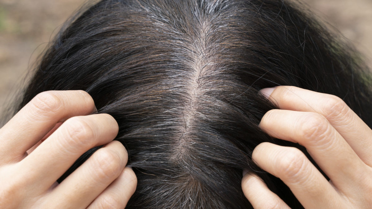 How to prevent grey hair 