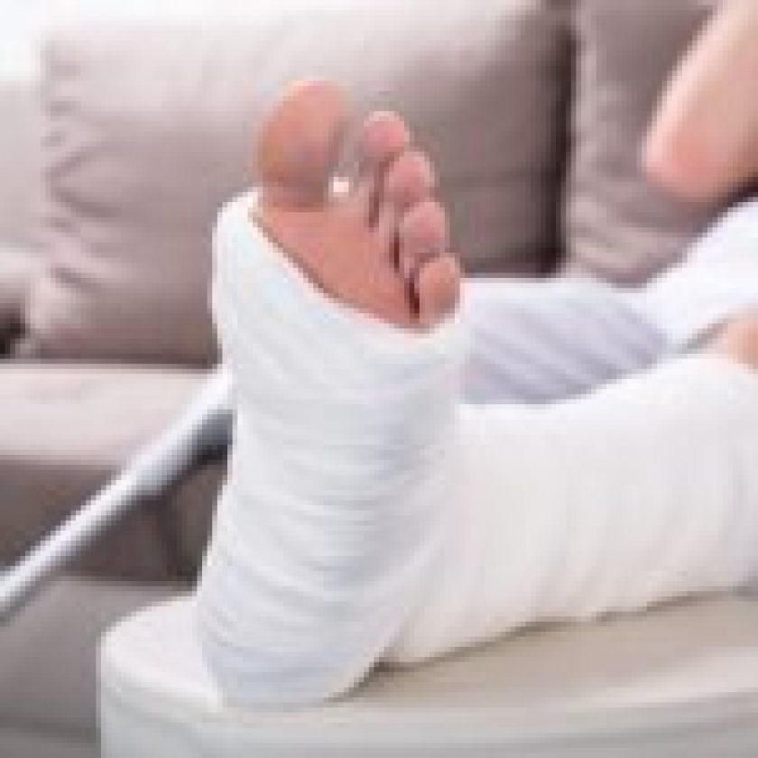 Broken Bone Injury Claim