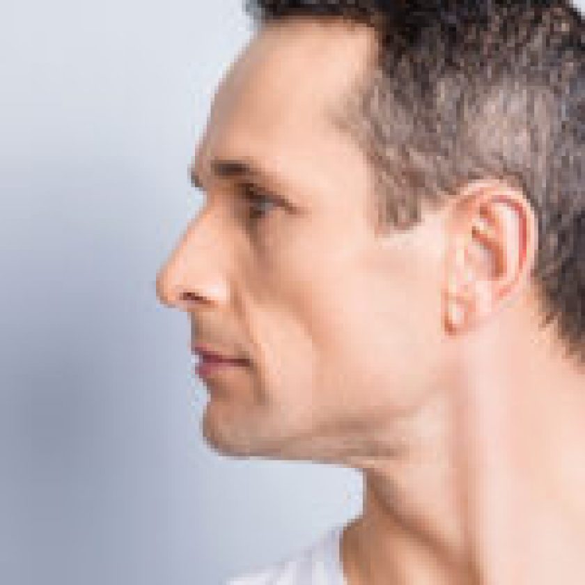 Challenges Involved with Reconstructive Rhinoplasty
