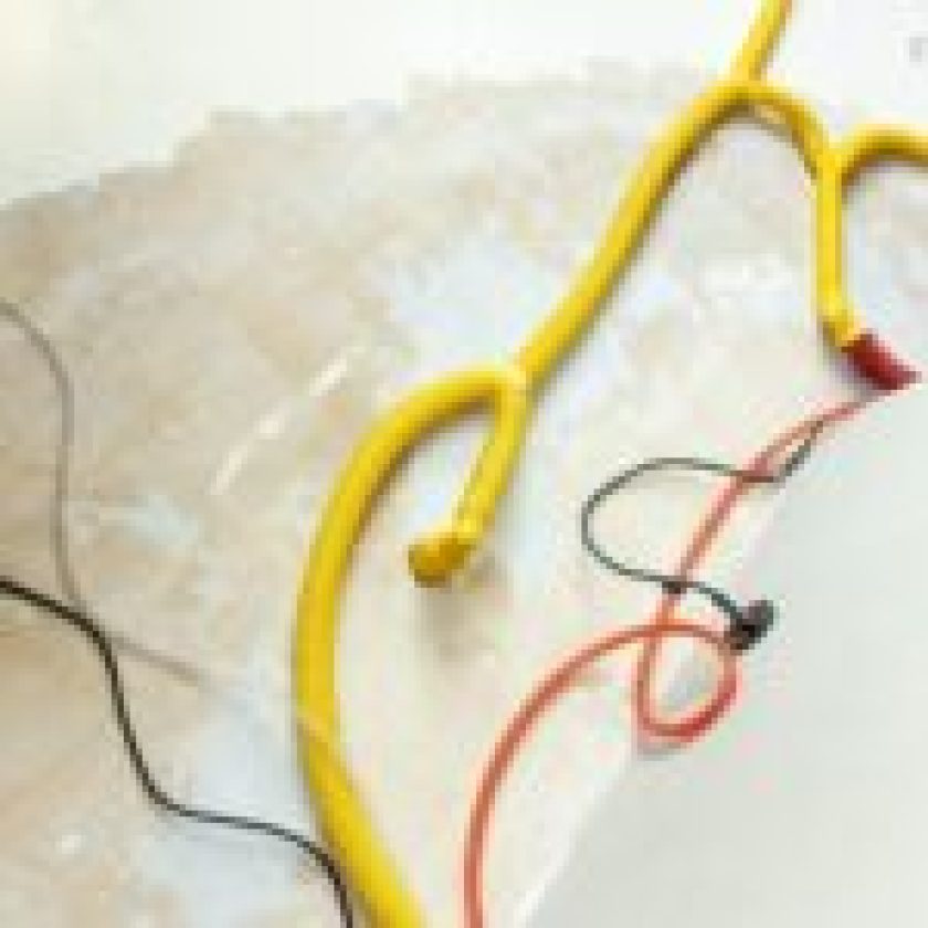 Common Causes of Water Damage