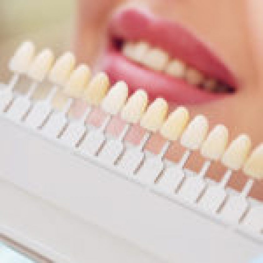 Cosmetic Dentistry