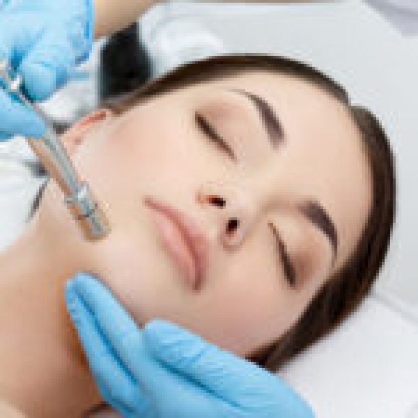 Microdermabrasion