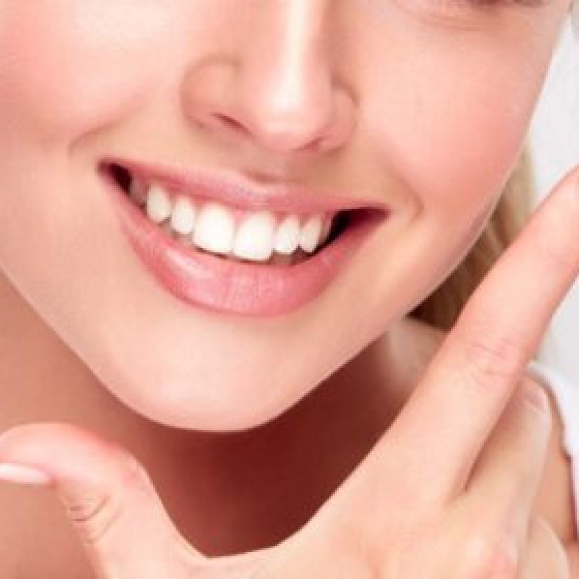 need Teeth Whitening